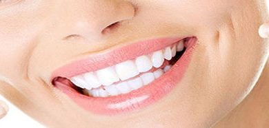 Cerec  Uygulaması nedir? Estetik Gülüş tasarımı Cerec yardımıyla nasıl yapılır ?