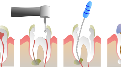 Endodonti