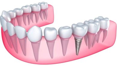 IMPLANT AMELİYATLARINDA KEMİK YETERSİZLİKLERİNDE KISA İMPLANTLAR GÜVENİLİR MİDİR?