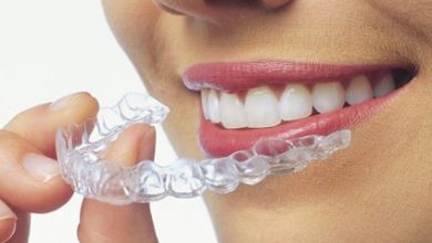 Invisalign