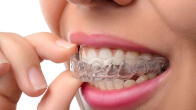 Invisalign Nedir?