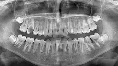 Oral Diagnoz ve Radyoloji